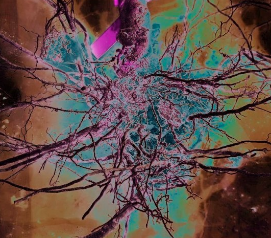 Arbuscular mycorrhiza – plant root endosymbiosis